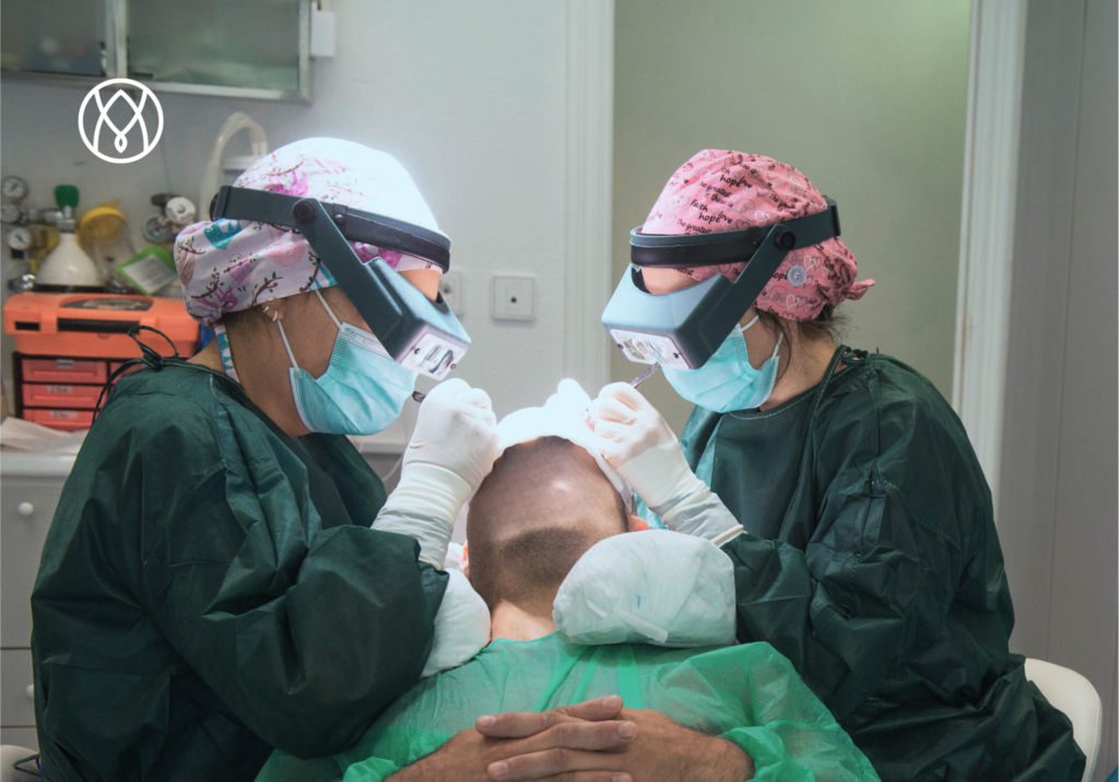 Métodos de implantación en trasplante capilar: dos especialistas realizando implantación de folículos capilares en paciente varón con pinzas. 
